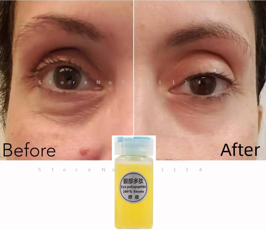 Instant Under Eye Serum Cream Gel Remove Dark Circles Crows Feet Bags Lift Firm Anti Aging