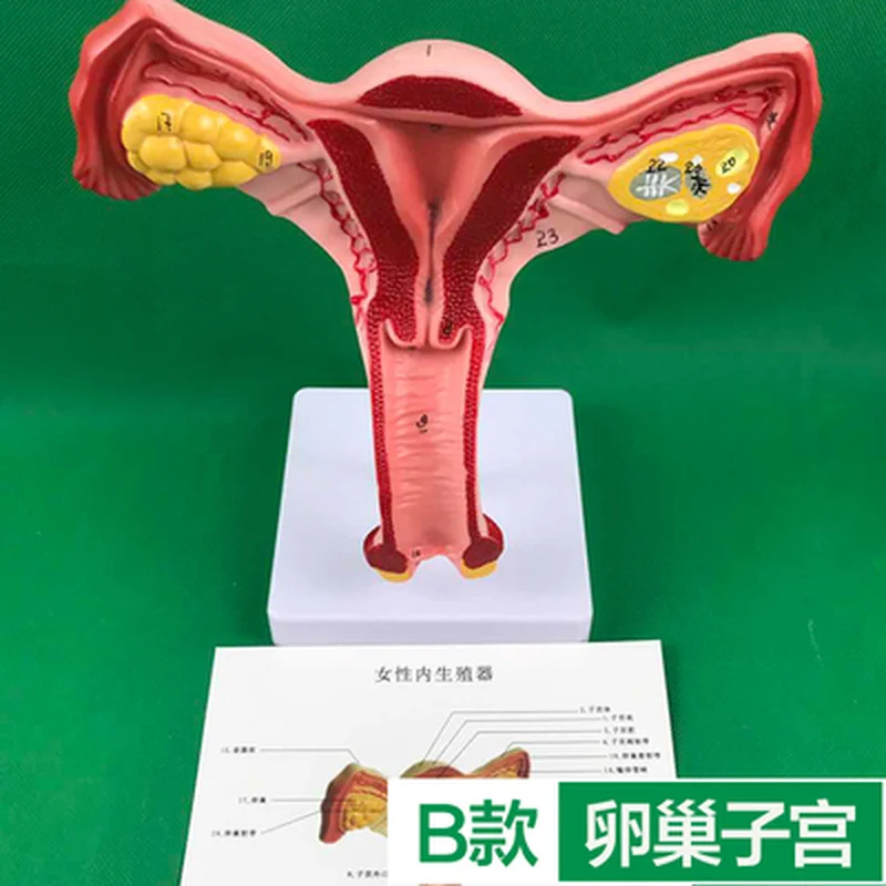 Ovary and uterus disease Dissection model Pathology Female uterus model teaching human medical aids anatomy lesion uterus