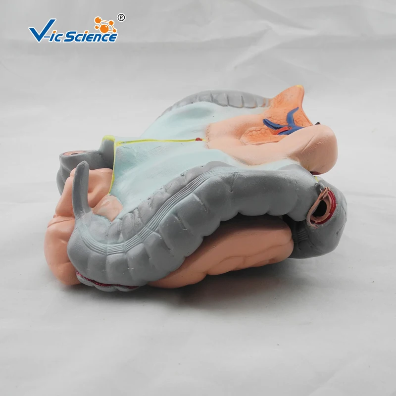 Modelo anatômico de colônia avançada, ileu e jejunum