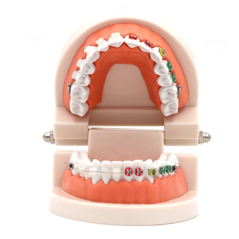 

Dental Orthodontic Treatment Model Typodont With Ortho Metal Ceramic Bracket Arch Wire Orthodontic Toothed Denture Model