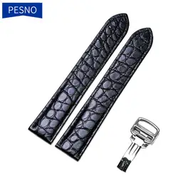 Pesno Unique Round Texture Alligator Skin Leather Watch Band Women Men Watch Accessories for Tank Rontonde