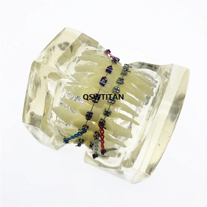 Dental Orthodontic Teeth Model Transparent Teeth Malocclusion Orthodontic Model With Brackets