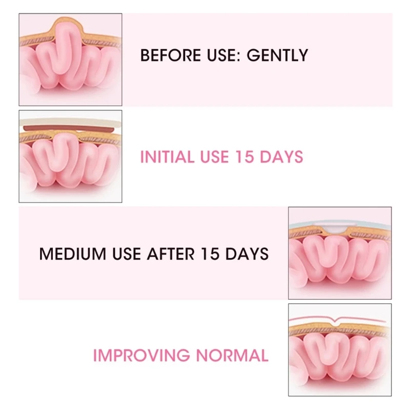 Рисунок 2 - Дышащая сумка из эластичного хлопка