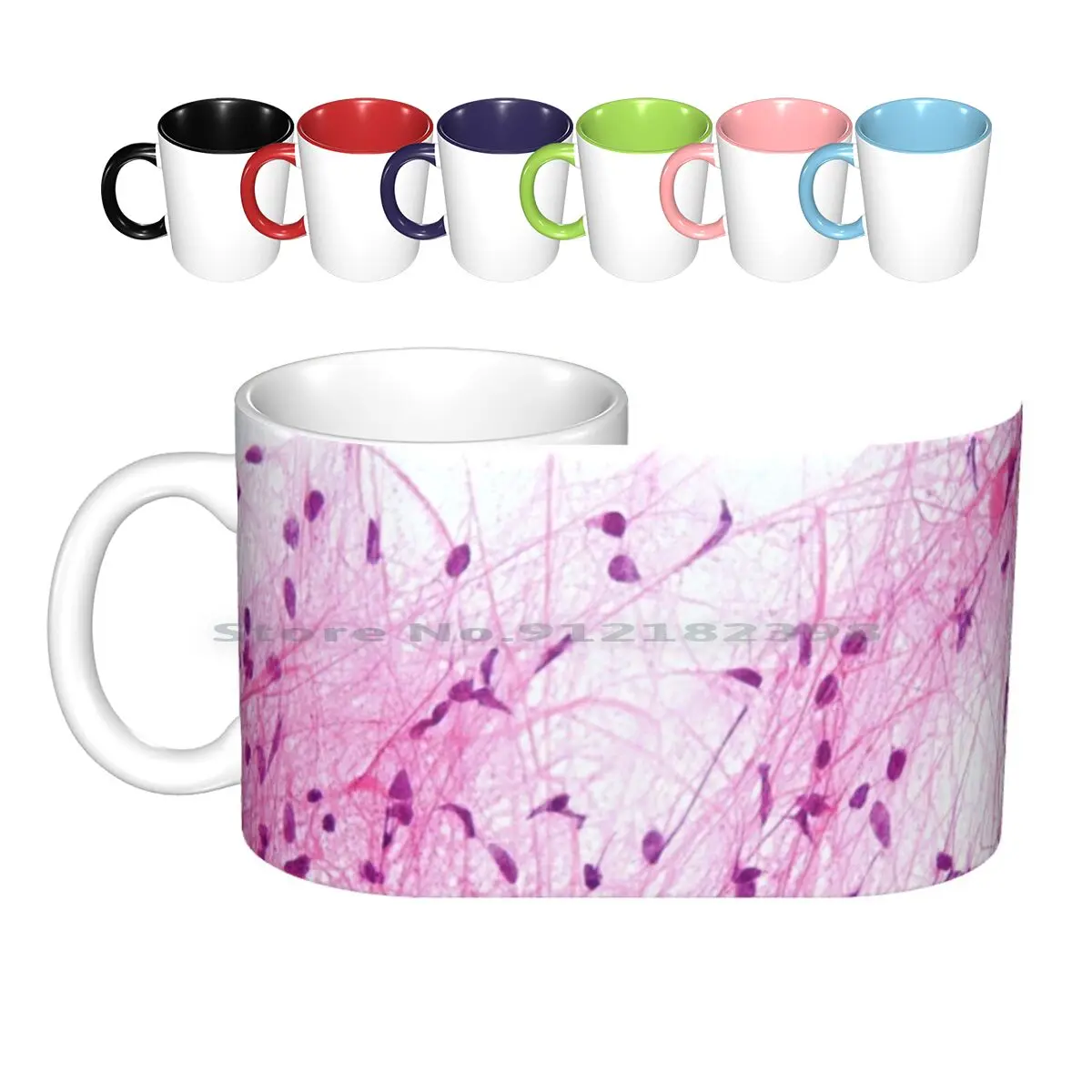 Astrocytoma Histology Ceramic Mugs Coffee Cups Milk Tea Mug Astrocytoma Brain Cancer Histology Histologist Histopathology