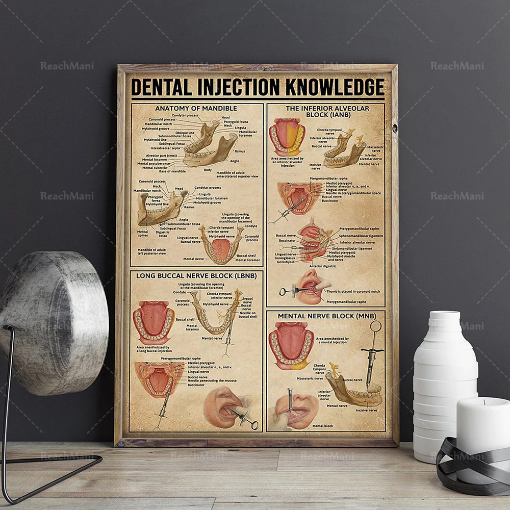 Dentist poster, dental injection knowledge, teeth and gum protection wall artist home decoration poster, dentist gift, unique gi