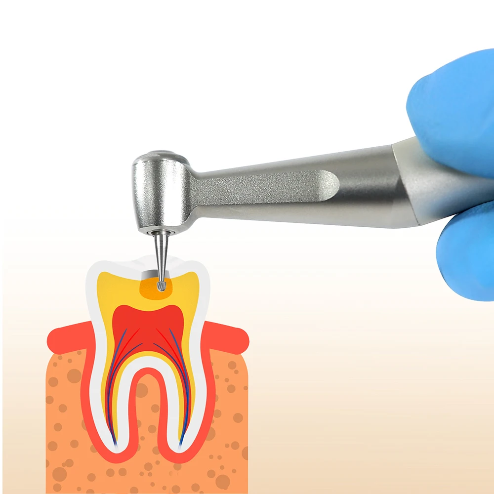 AZDENT 5 teile/schachtel Dental Wolfram Hartmetall Bohrer Niedriger Geschwindigkeit Runde RA Serie Für Dental Labor oder Klinik Schaft Dia.= 2,35mm