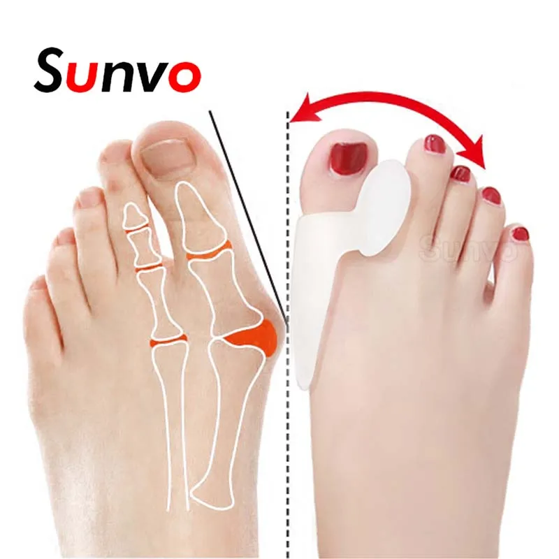 Separador de dedos del pie de silicona, férula de juanete, Corrector superpuesto de hueso, Hallux Valgus, inserto de zapato, herramientas de ortesis para el cuidado de los pies, 1 par