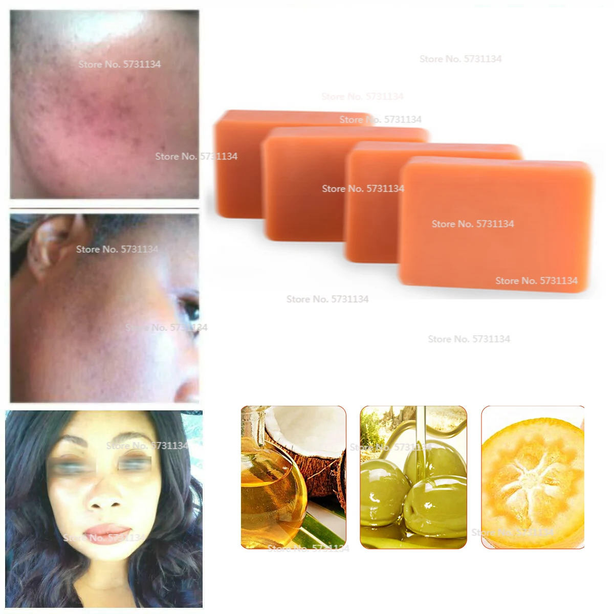 Kojic Acid Soap Brightening Lightening Papaya, 4%Kojic Acid,Glutathione,Turmeric