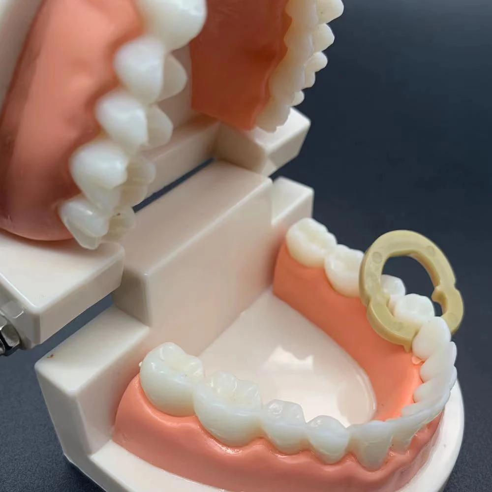 Tandheelkundige hars klemring Scheidingsring Sectionele voorgevormde metalen matrices Matrix Matrix