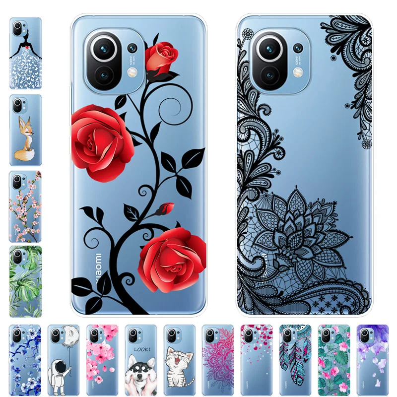 For Xiaomi Mi 11 Ca…