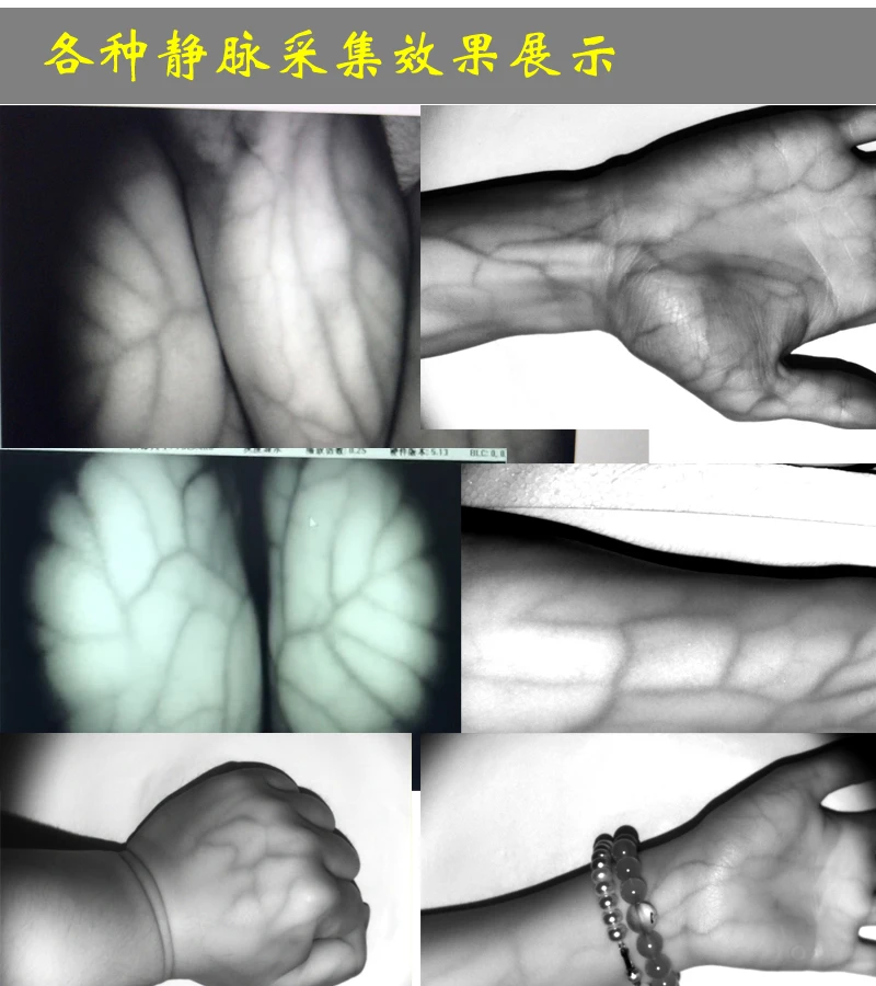 USB Integrated Real-time Vein Acquisition Camera-provides a Complete SDK for Extraction and Verification of Vein Algorithm