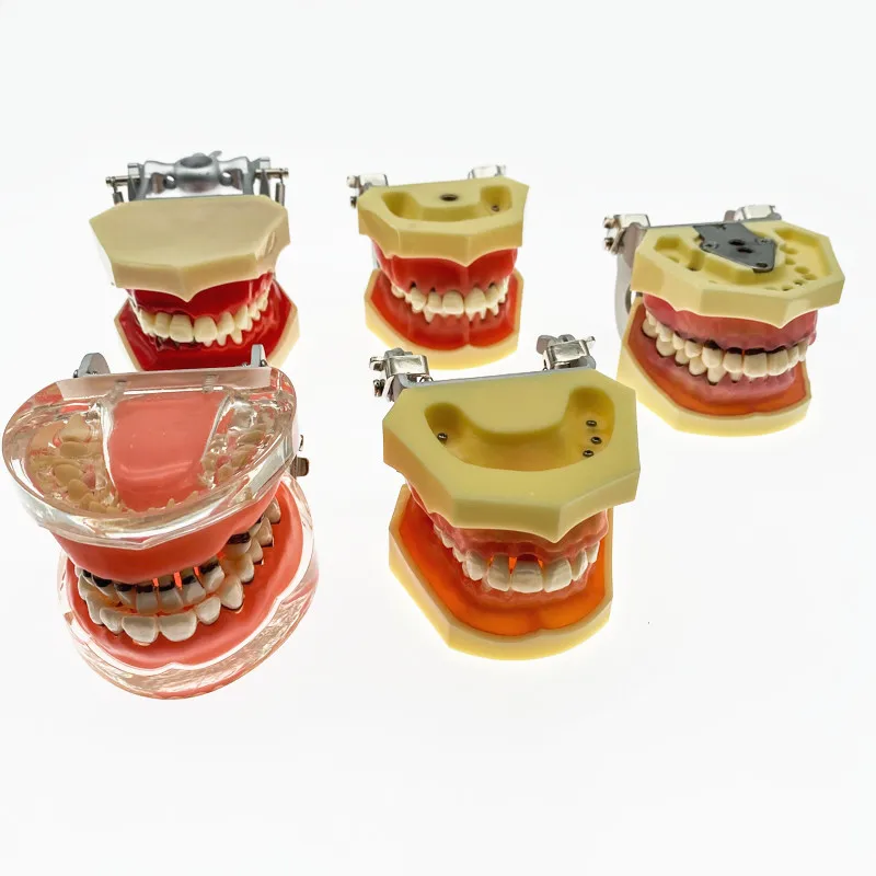 

Dental Teeth Model Simulation Model Study Adult Pathological Periodontal disease for Oral Teeth model