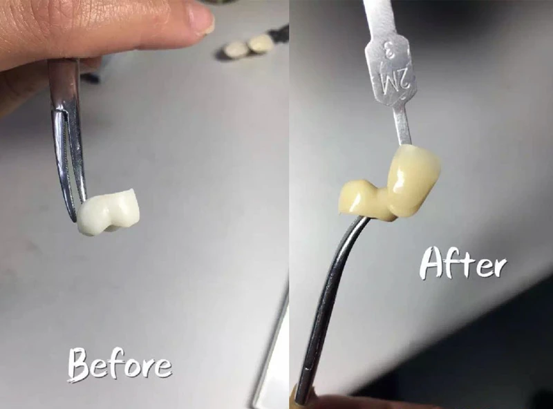 Beautyzir Dental Lab زركونيا جليز كلاسيك (1 زجاجة) 16 لونًا مواد زجاجية #4