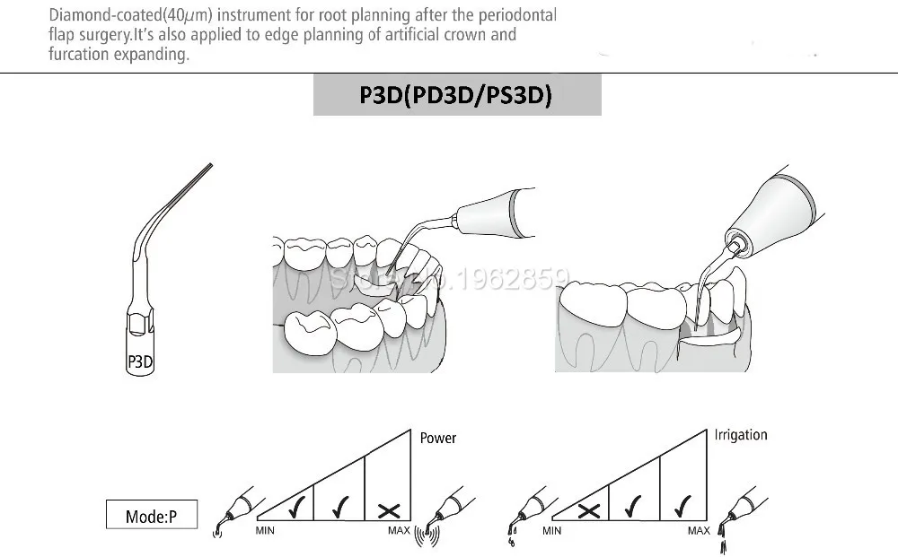 5pcs P3D scaler tips tools for dentist teeth whitening dental instrument ultrasonic dental scaler tip for EMS & Woodpecker