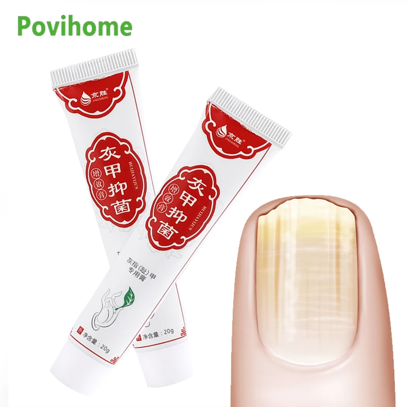 20g Onychomycosis Anti Fungal Cream Natural Herbal Nail Repai Ointment Fingernails Toenail Remove Thick Gray Nail Repair Plaster