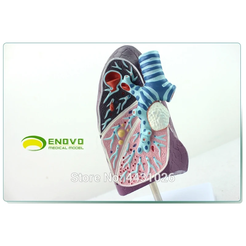 ENOVO Medical human lung model smoker tuberculosis pneumonia thoracic respiratory department model health