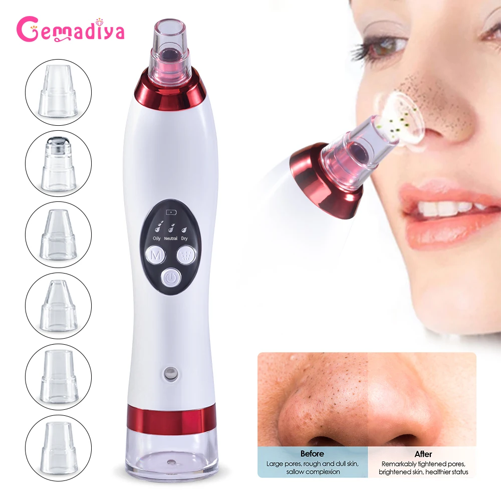 

Blackhead Remover Nose Face Cleansing T Zone Blackhead Point Vacuum Suction Facial Clean Skin Moisturizer Humidifie Beauty Tools