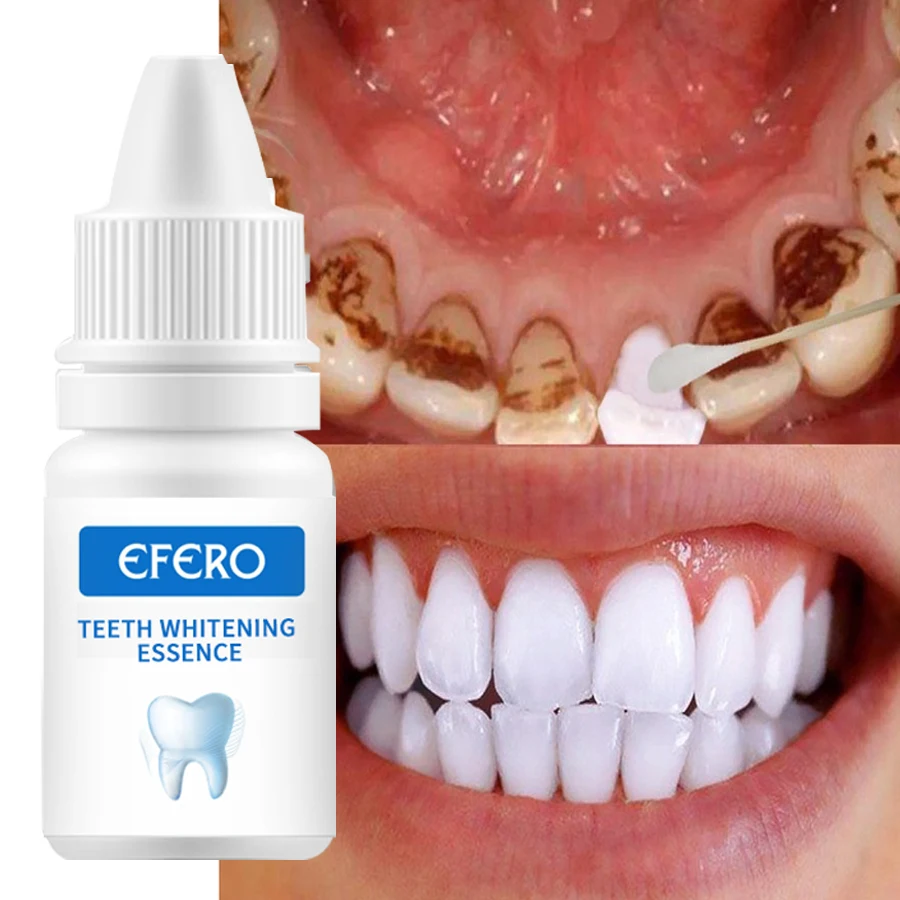 Teeth Whitening Serum Gel Dental Oral Hygiene Effective Remove Stains Plaque Teeth Cleaning Essence Dental Care Toothpaste