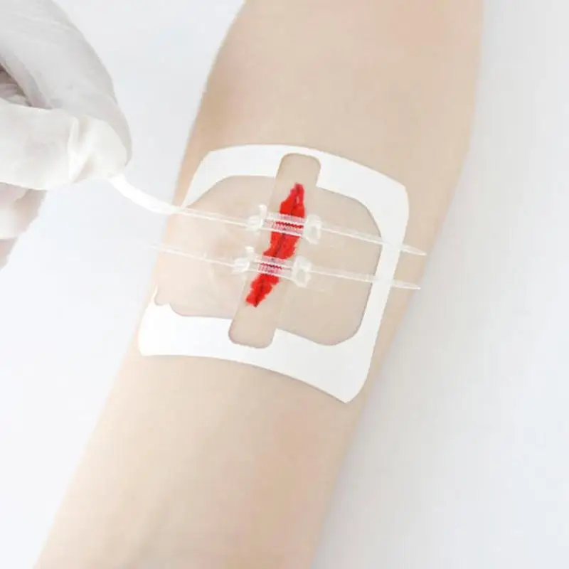 Parche hemostático para cierre de heridas, accesorio de sutura rápida con cremallera, 1/3/5 piezas, portátil para exteriores