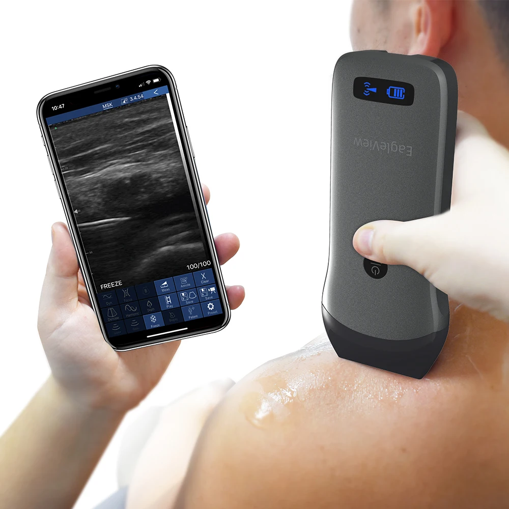 

Portable Wireless Ultrasound Scanner Gel Vascular Therapeutic Handheld Machine Linear Wireless USB Free Gift Smart Tablets