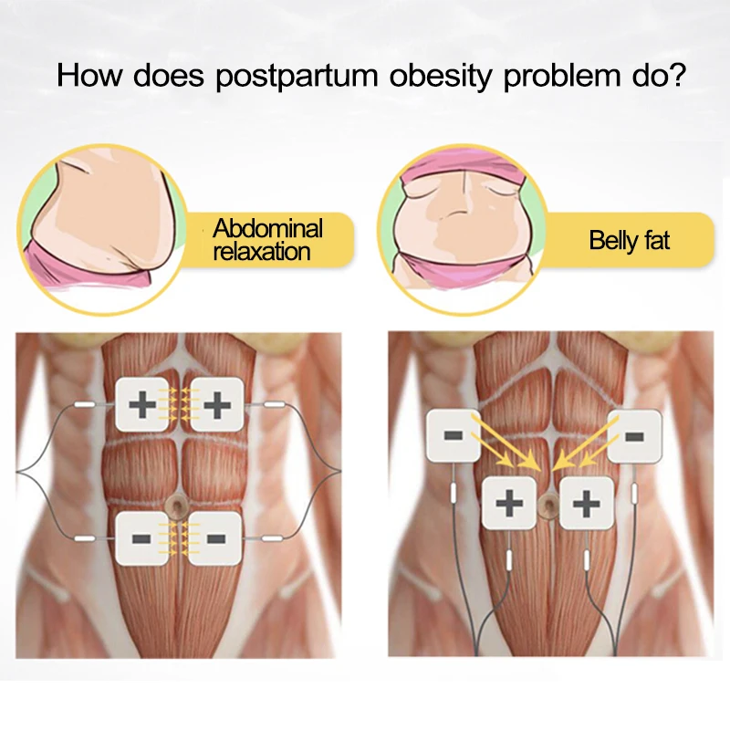 TENS Kegel Trainer Muscolo del pavimento pelvico per donna 11 programmi preimpostati per incontinenza, prolasso e sensazione intima migliorata