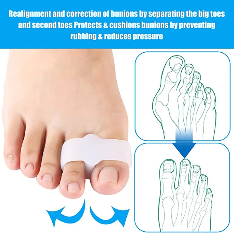 2pcs=1 Pair Foot Care Tool Bunion Hallux Valgus Corrector Thumb Finger Correction Straightener Silicone Toe Spreader Separator