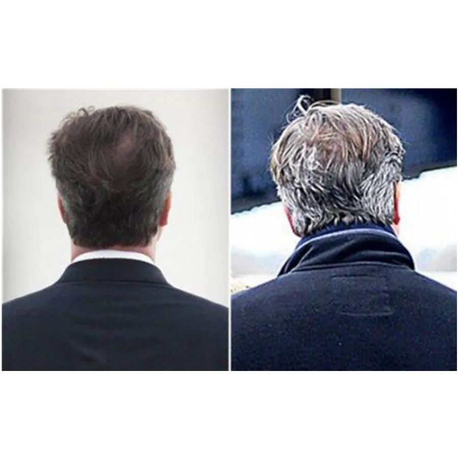 White Hair Turn Black Promote Hair Growth Alopecia Bald Cure Products Stop Hair Loss Polygonum Multiflorum Powder for Men Women