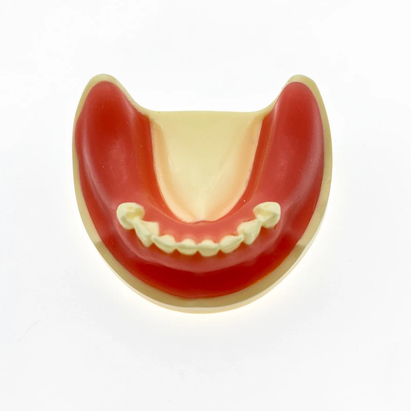 

Teeth model Dental Implant model For incision drilling Practices suture and planting exercises with imitation bone