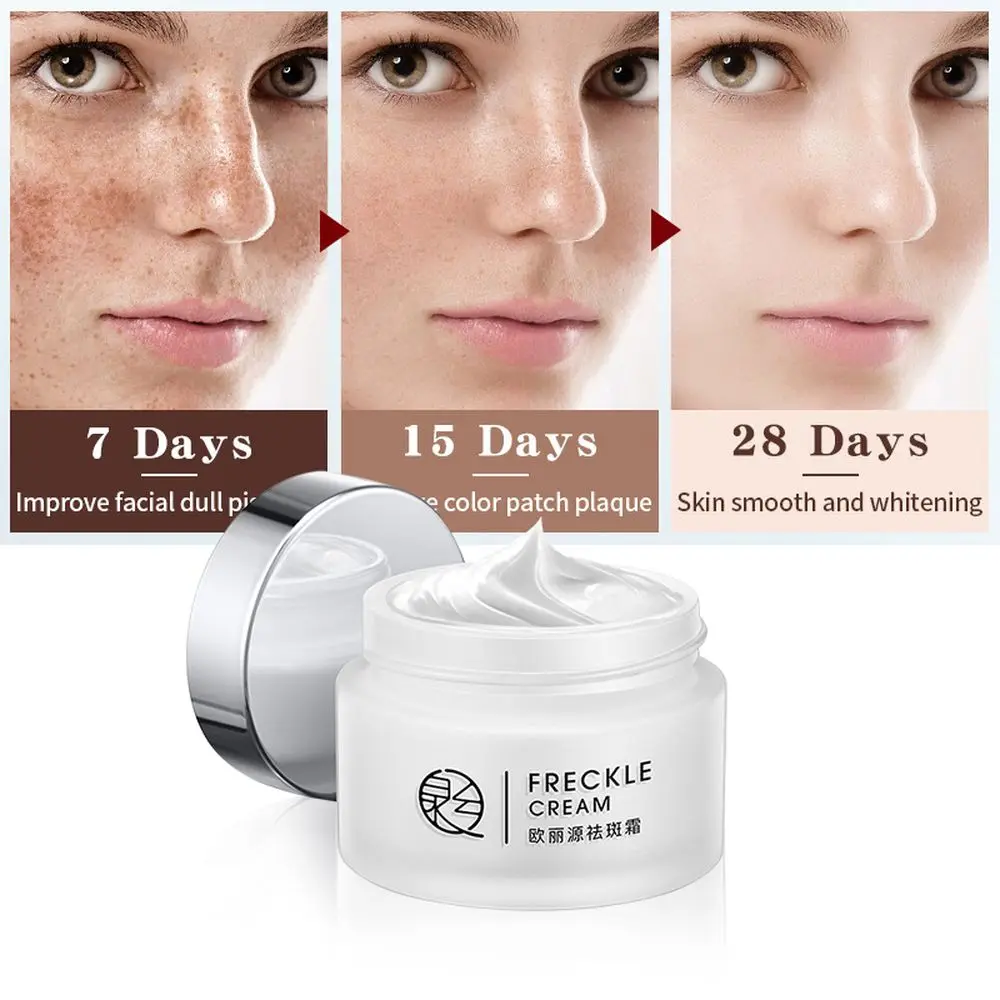 LAIKOU Pure Whitening Freckle Facial Cream Repair Remove Melasma Acne Spots Pigment Melanin Dark Spots Skin Brightening Cream