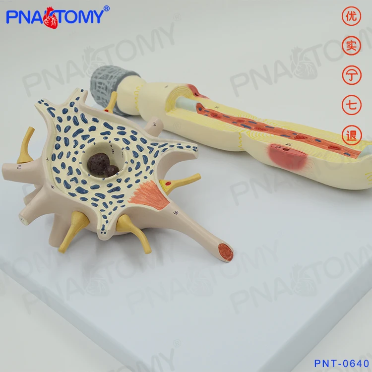 2500 Times Enlarged Neuron Model Nervous System PNT-0640  Anatomia Reproductor Masculino  Medical Science  Human Anatomy Nerv