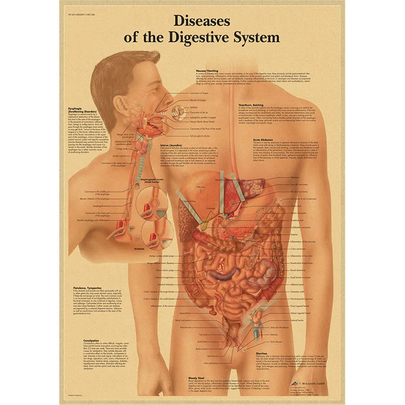 Human Anatomy Muscle System Kraft Paper Poster Anatomy Diagram Human Medical Wall Medical Education Office Decorative Mural