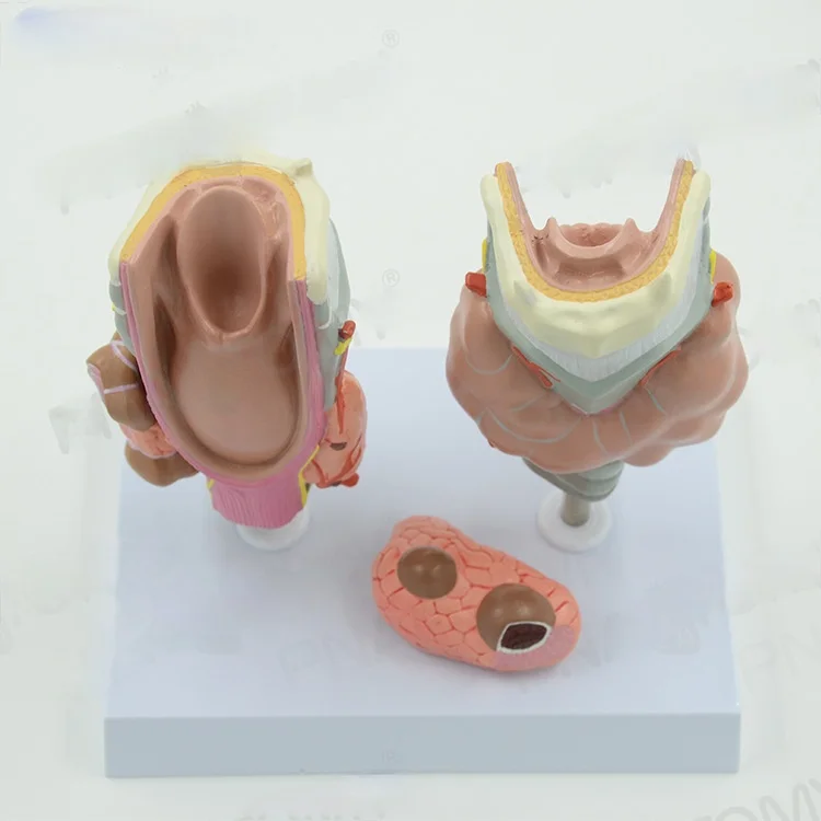 Thyroid Pathology Medical Anatomical Model of Larynx Hyperthyroidism Hypothyroidism Endocrine System Internal Medicine Specimens