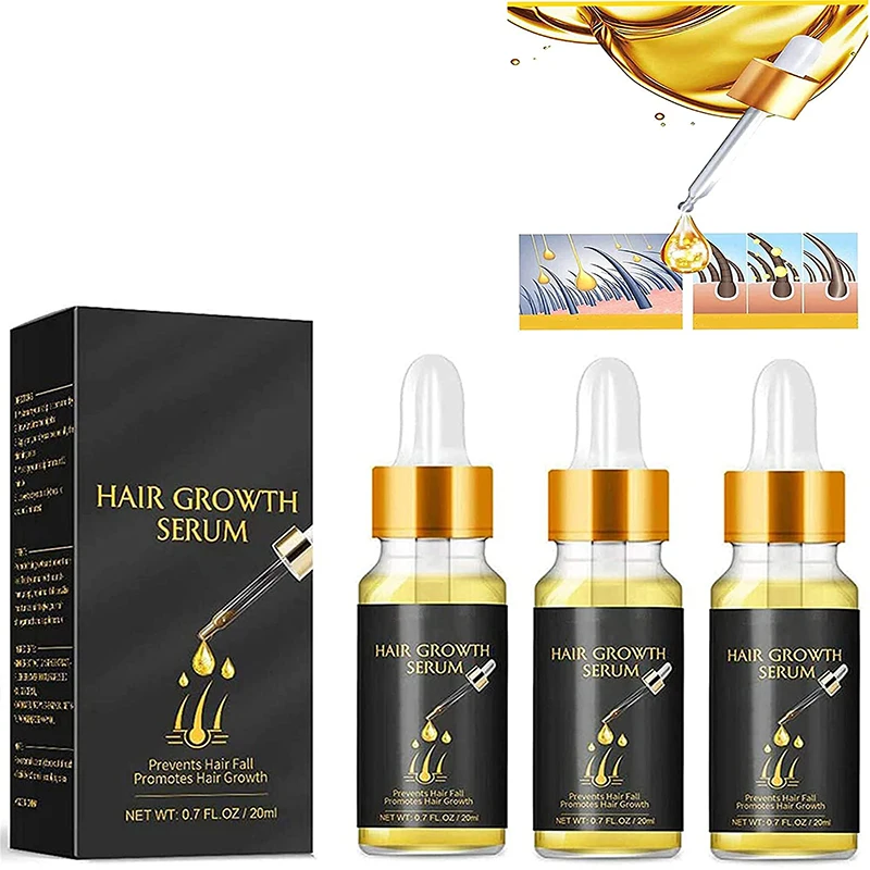 20ML Ginger Fast Hair Growth Serum Hair Loss Treatment Essential Oil Prevention Liquid for Hair Regrowth Thicker Longer Stronger