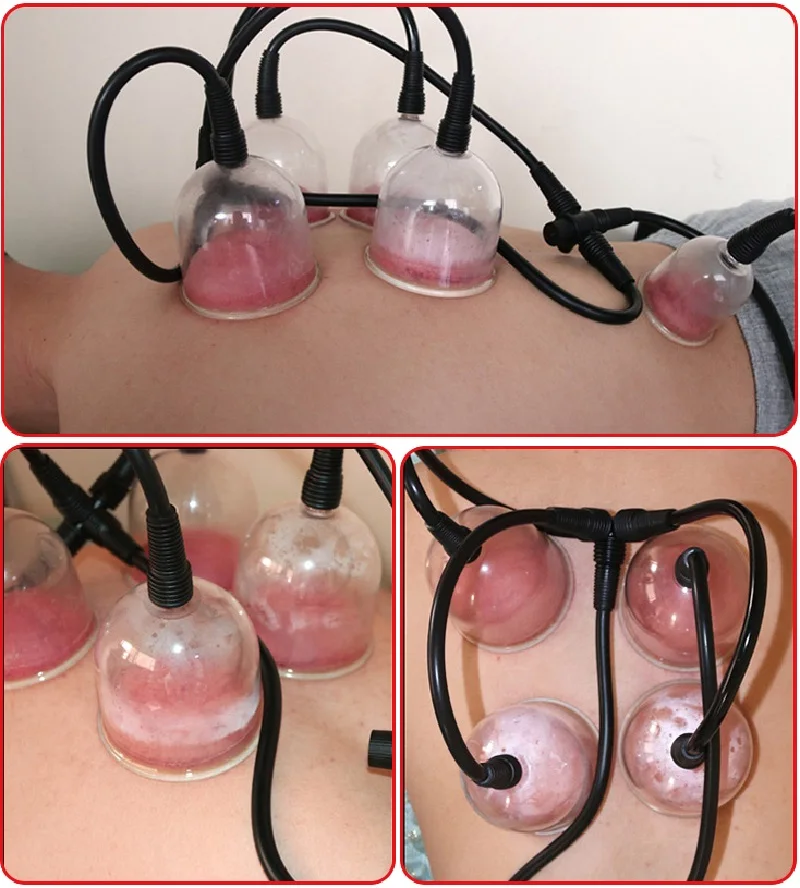 4 Pcs 7.4CM Diameter Hijama Suction Cups For Breast Massage Enlargement Machine Body Vacuum Therapy Cupping Massager