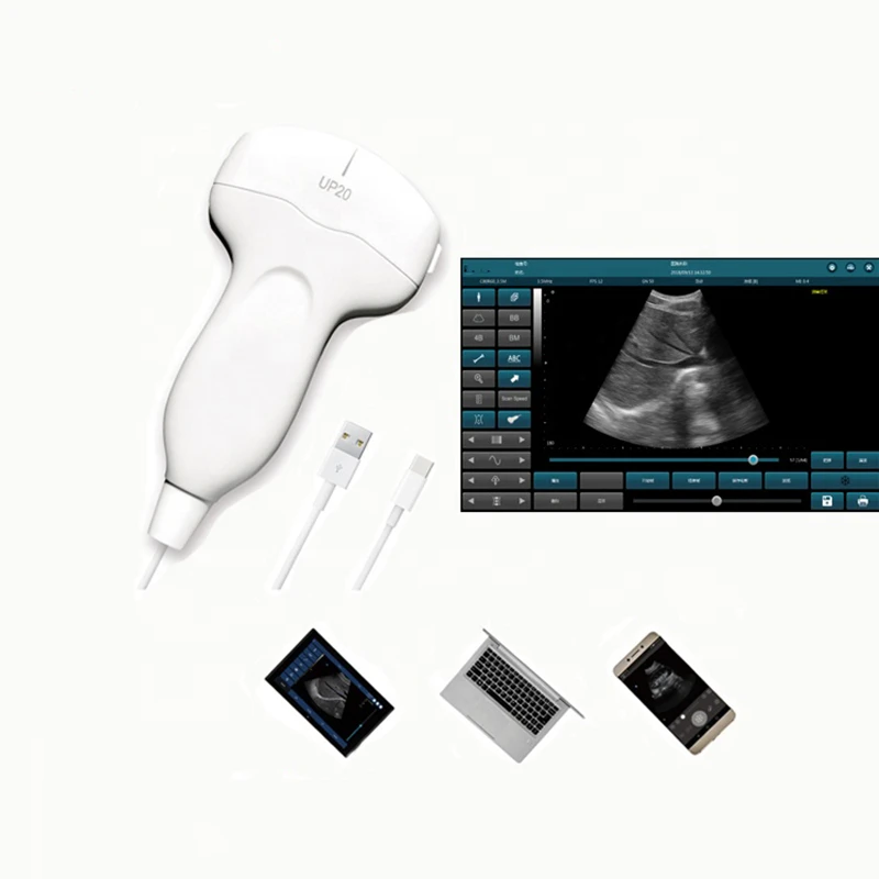 Portable Pocket Handheld USB Convex Black and White Digital Ultrasound Scanner Probe