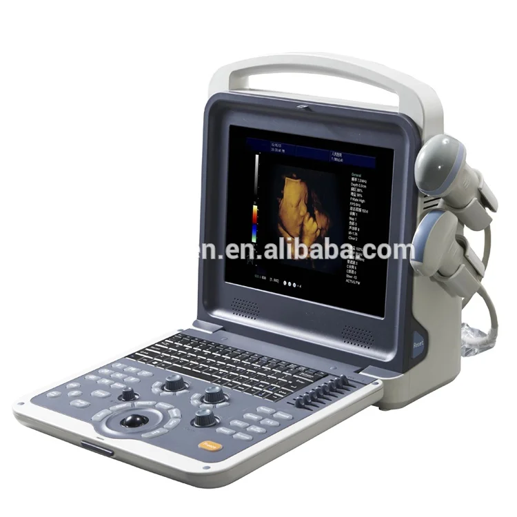 High performance most economic 3D 4D color doppler portable ultrasound