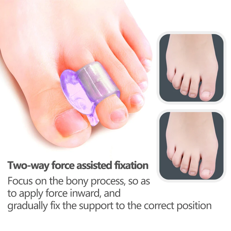 10 Chiếc Gel Silicone Mũi Tách Ngón Tay Cái Chồng Lên Nhau Corrector Bunion Do Khoang Cach Bang Hallux Valgus Chỉnh Hình Chăm Sóc Chân Công Cụ Hỗ Trợ