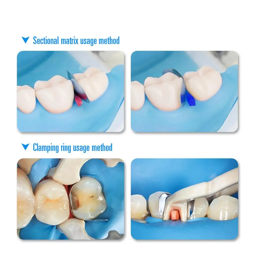 Dental section Matrix System Band Metal żywica zacisk pierścień oddzielający autoklawowalne narzędzia dentystyczne