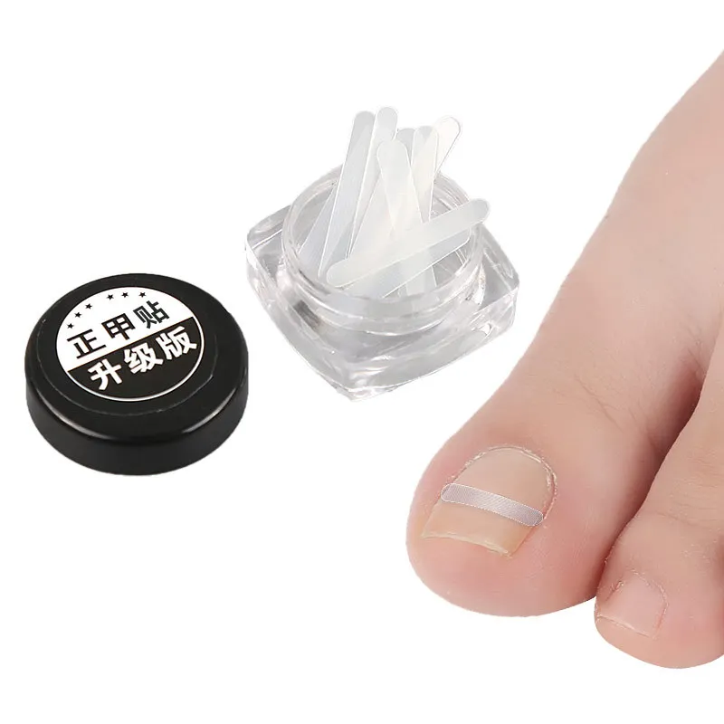 Outil de Correction des ongles incarnés, 10 pièces, Patch élastique de traitement des ongles incarnés, Clip de redressement, outil de pédicure