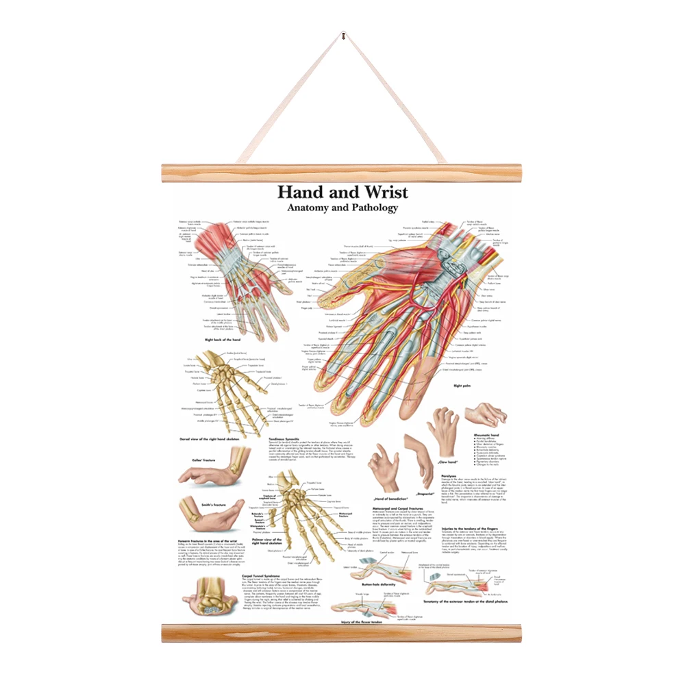 Human Anatomy Muscles Arm Leg shoulder Foot Anatomical Chart Pathology Poster Canvas Painting Wooden Scroll Painting frame Home