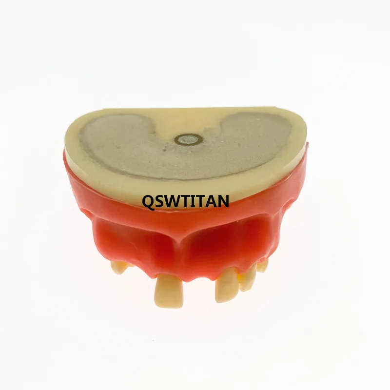Dental Sinus Lift Practice Teeth Model Typodont Study Model Demonstration teaching tooth model