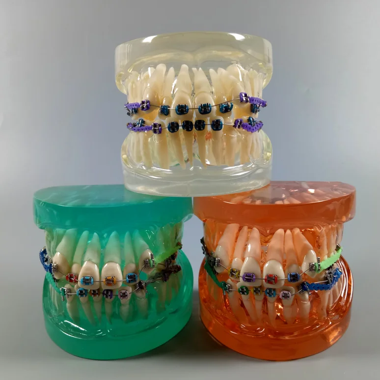 

3Colors Dental Study Model Orthodontic Demonstrate School Teaching Tool Crystal Blue Clear Orange