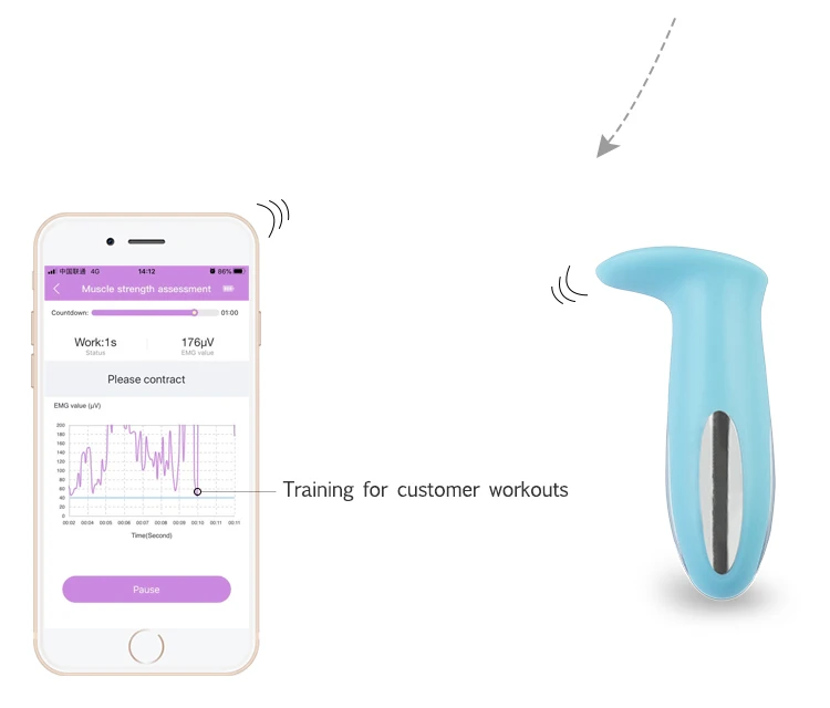 Wireless APP Pelvic Floor Muscle Training for Kegel EMG&ETS Therapy uracratia Pelvic organ prolapse&POP Improve vaginal laxity