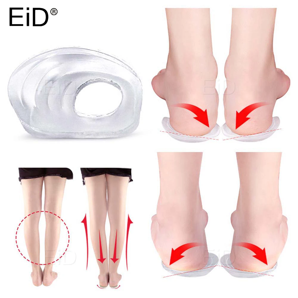 Silicone Orthopedic Shoes Sole Insoles O/X Type Leg Insoles Shoe Inserts Medial Lateral Heel Wedge Lift Silicone Pads Corrective