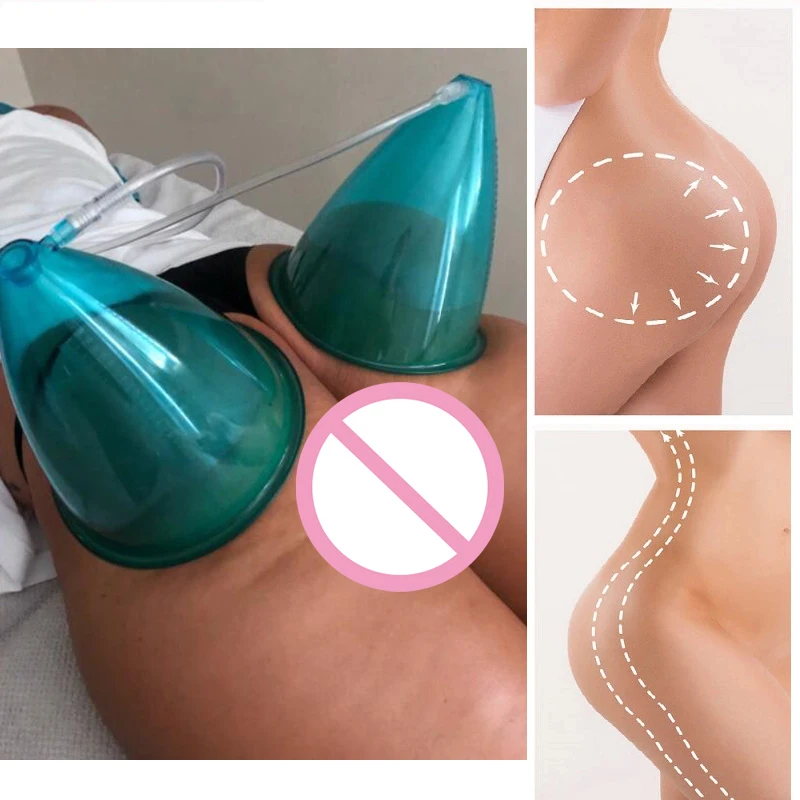 Vacumterapia Maquina coporal con copas para Bustos y gluteos - vacum terapia para gluteos y drenaje linfatico colombian body sculpting