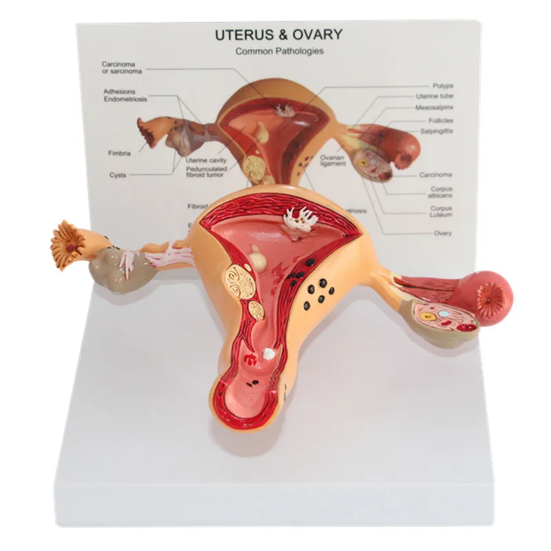 

1:1 Pathological Uterus and Ovary Anatomical Model In Trauma Anatomy Skeleton Dental Anatomical Shadow Medical Training Manikins