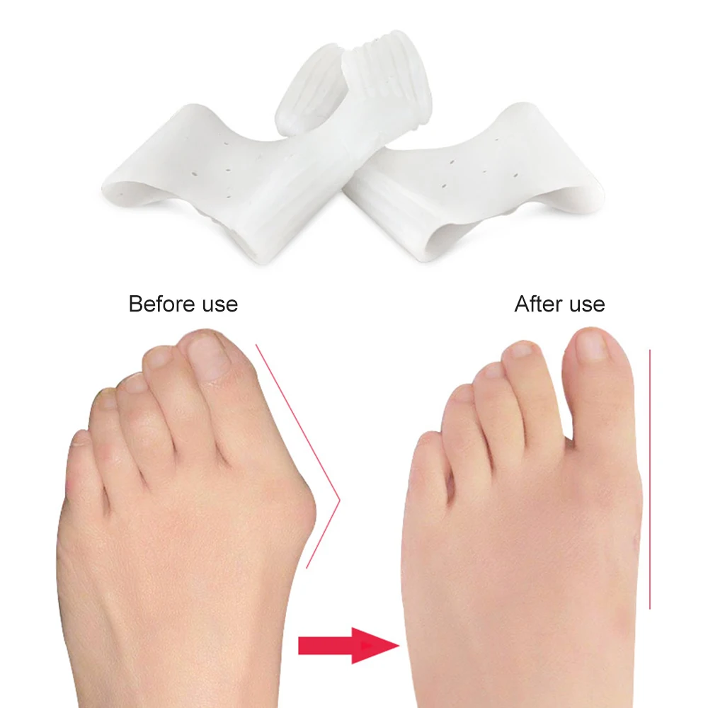 1 Pasang Bantuan Korektor Bunion Silikon, Pemisah Jempol Kaki Besar Pelurus Kaki untuk Hallux Valgus dan Jempol Kaki Besar Pereda Nyeri Sendi