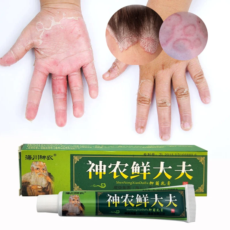 15g Natural Chinese Medicine Herbal Anti Bacteria Cream Psoriasis Eczema Ointment Treatment High Quality Herbal Cream