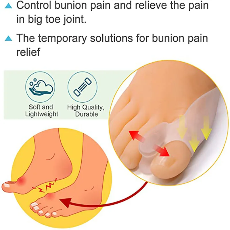 Coussin correcteur d'hallux Valgus en Silicone, séparateur d'orteils et de doigts, soulage la douleur des oignons, redresseur du gros orteil, outil de soins des pieds, 2 pièces