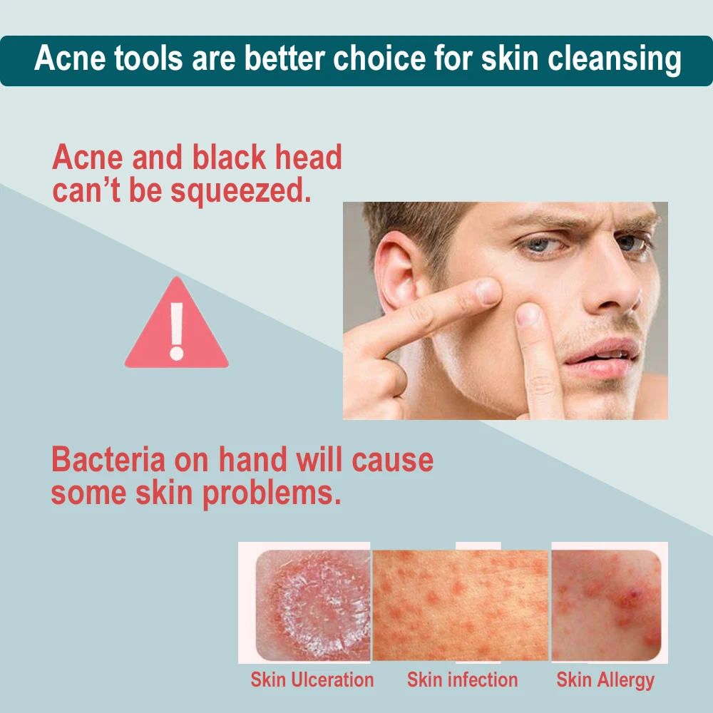 Инструмент для ухода за кожей из нержавеющей стали, средство для чистки лица, экстрактор черных точек, средство для удаления комедонов